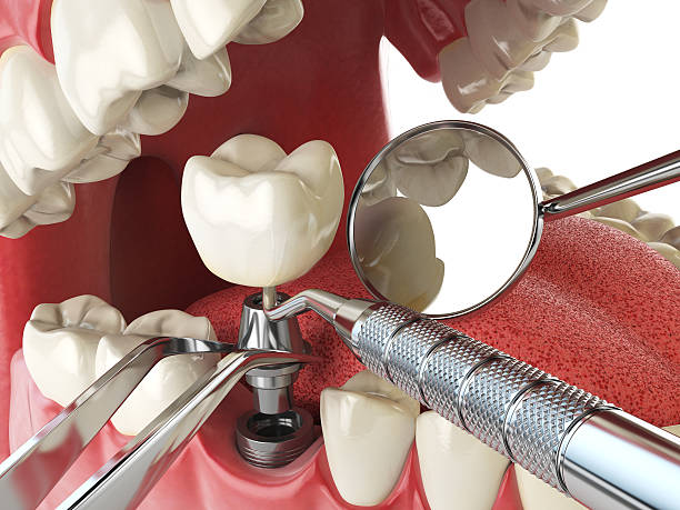 Best Cracked Tooth Emergency Dentist  in Wartburg, TN